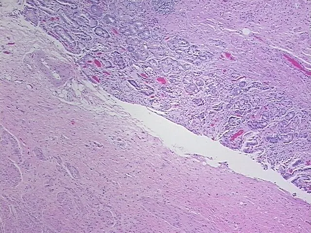 Tissue FFPE Sections, Gastroesophageal junction - image 1