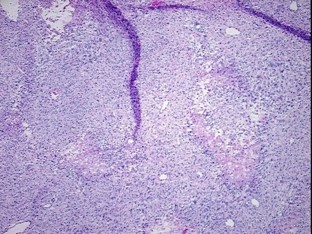 Tissue FFPE Sections, Appendix - image 1