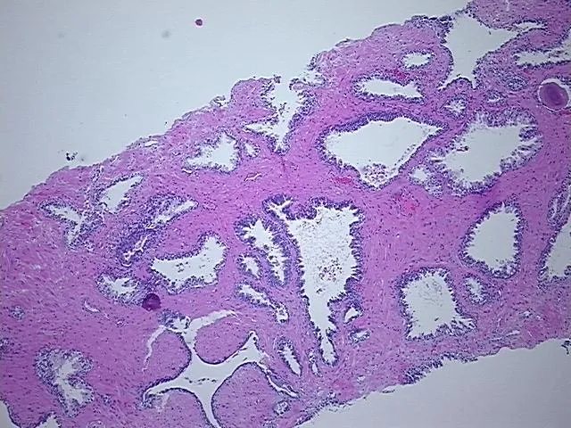 Tissue FFPE Sections, Prostate - image 1