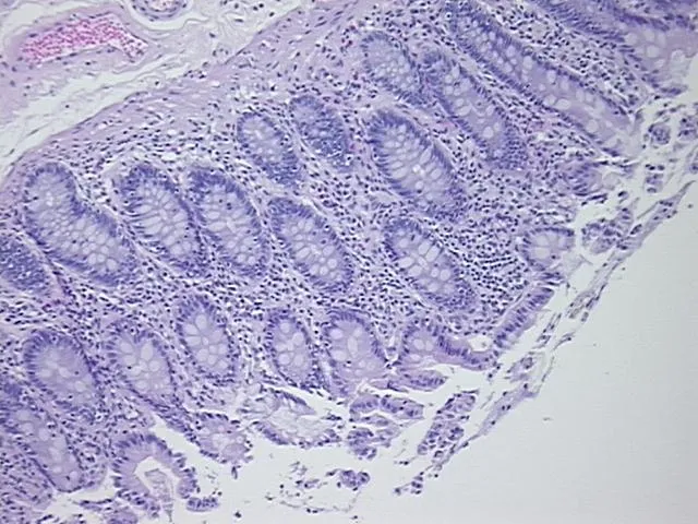 Tissue FFPE Sections, Colon - image 1