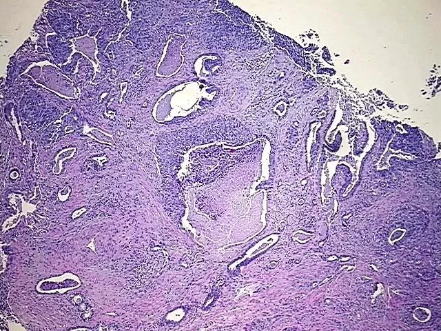 Tissue FFPE Sections, Cervix - image 1
