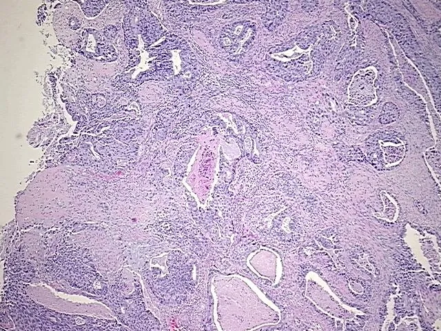 Tissue FFPE Sections, Cervix - image 1