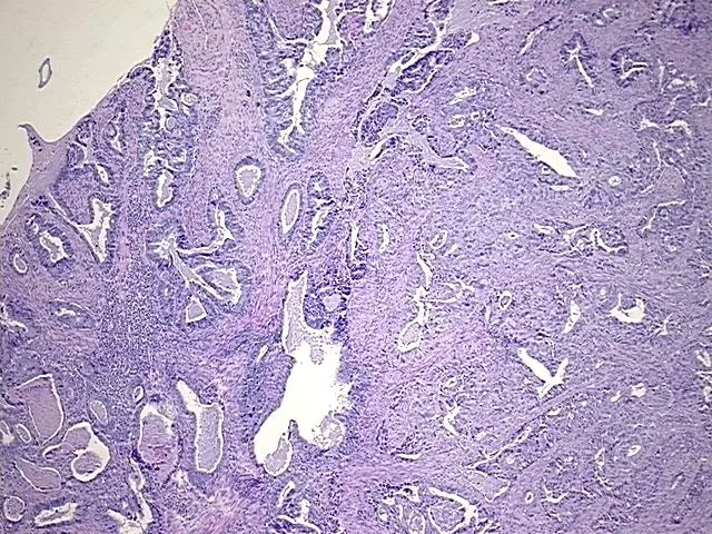 Tissue FFPE Sections, Cervix - image 1