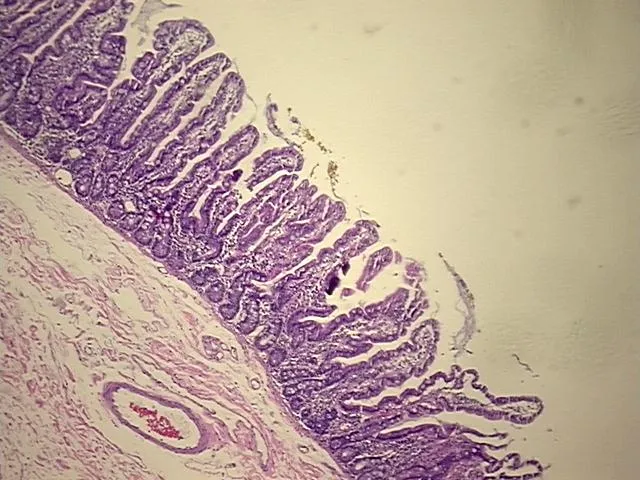 Tissue FFPE Sections, Duodenum - image 1