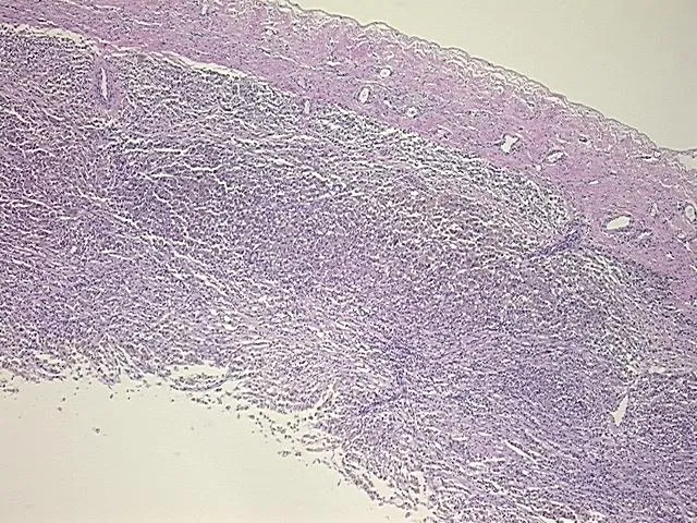 Tissue FFPE Sections, Endometriotic tissue - image 1