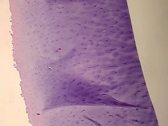 Tissue FFPE Sections, Cartilage - image 1