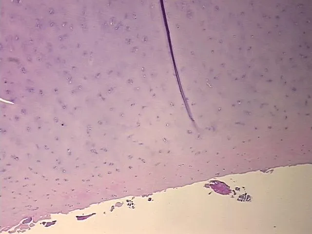 Tissue FFPE Sections, Cartilage - image 1
