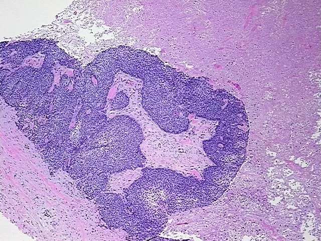 Tissue FFPE Sections, Pharynx - image 1
