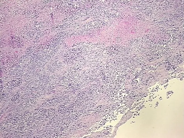 Tissue FFPE Sections, Unknown tissue - image 1