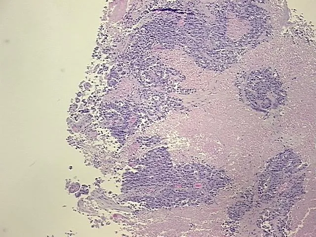 Tissue FFPE Sections, Unknown tissue - image 1