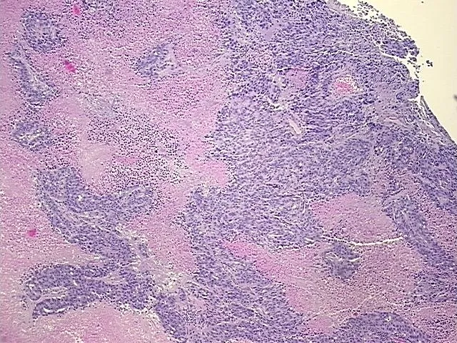 Tissue FFPE Sections, Unknown tissue - image 1