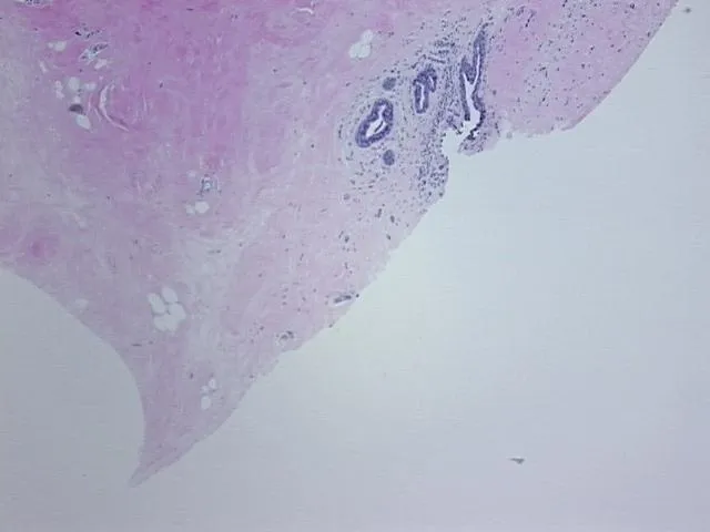 Tissue FFPE Sections, Breast - image 1