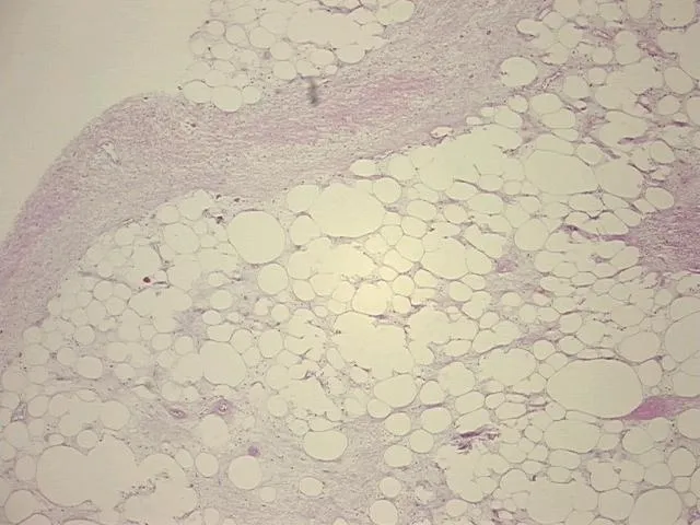 Tissue FFPE Sections, Soft tissue - image 1
