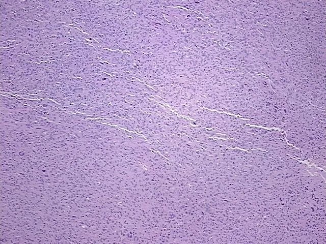 Tissue FFPE Sections, Soft tissue - image 1