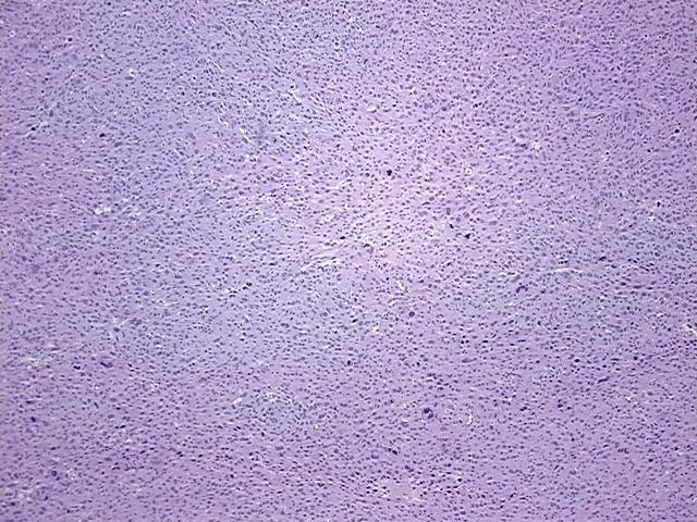 Tissue FFPE Sections, Soft tissue - image 1