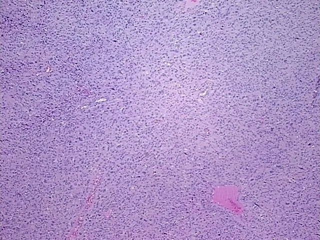 Tissue FFPE Sections, Soft tissue - image 1