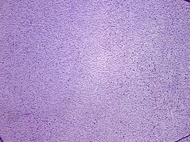 Tissue FFPE Sections, Soft tissue - image 1