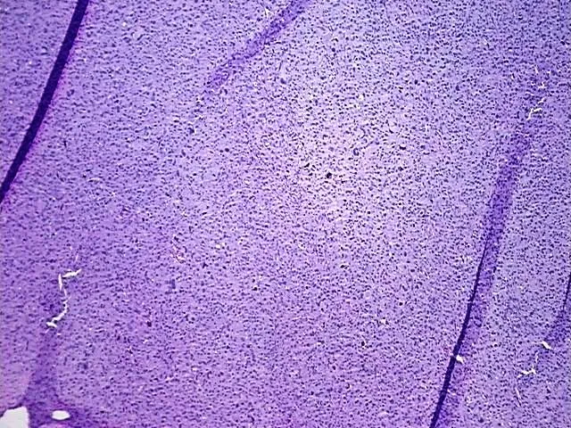 Tissue FFPE Sections, Soft tissue - image 1