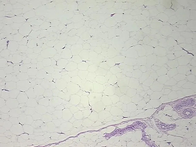 Tissue FFPE Sections, Adipose tissue - image 1