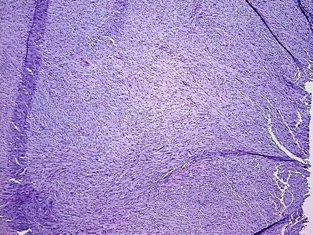 Tissue FFPE Sections, Soft tissue - image 1