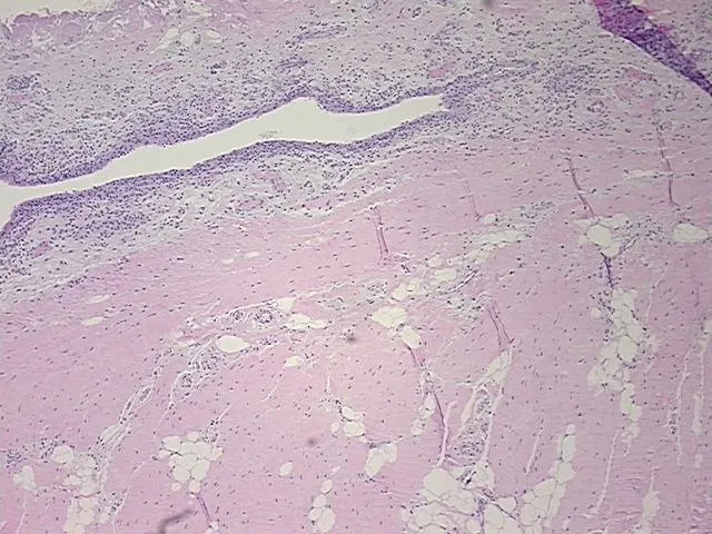 Tissue FFPE Sections, Joint - image 1
