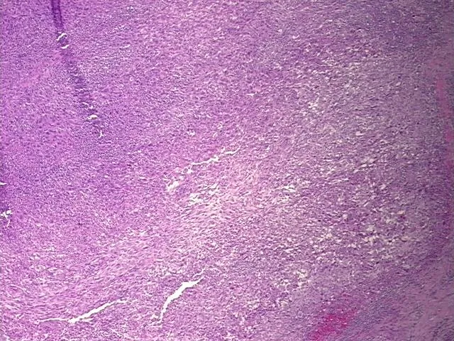 Tissue FFPE Sections, Lung: left lower lobe - image 1