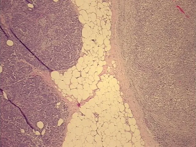 Tissue FFPE Sections, Lymphoid tissue - image 1