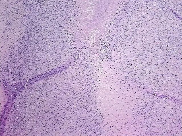 Tissue FFPE Sections, Soft tissue - image 1