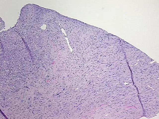 Tissue FFPE Sections, Soft tissue - image 1