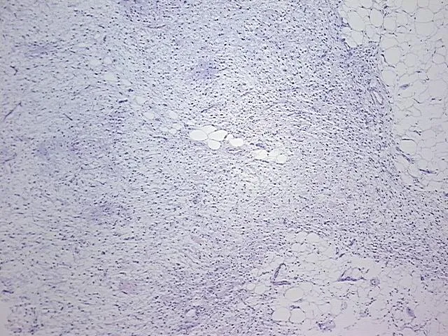 Tissue FFPE Sections, Soft tissue - image 1