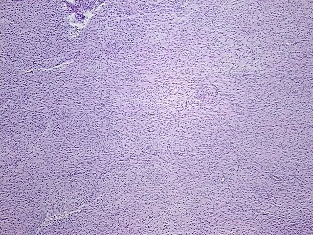 Tissue FFPE Sections, Soft tissue - image 1