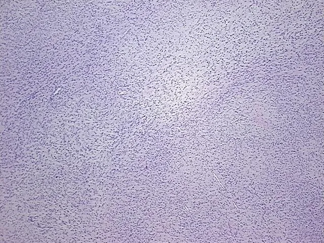 Tissue FFPE Sections, Soft tissue - image 1