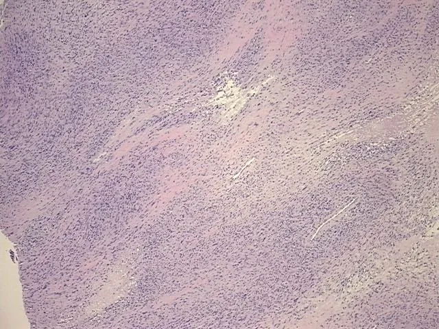 Tissue FFPE Sections, Soft tissue - image 1