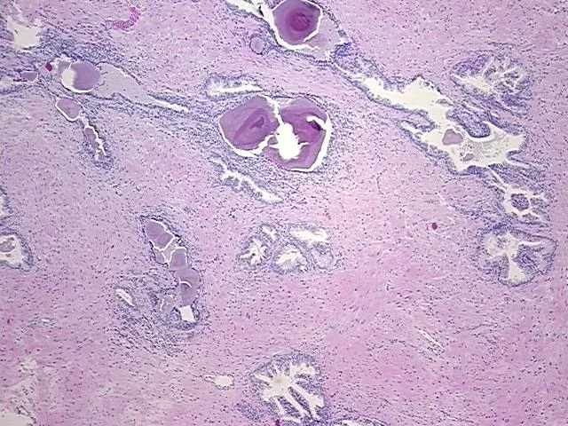 Tissue FFPE Sections, Prostate - image 1