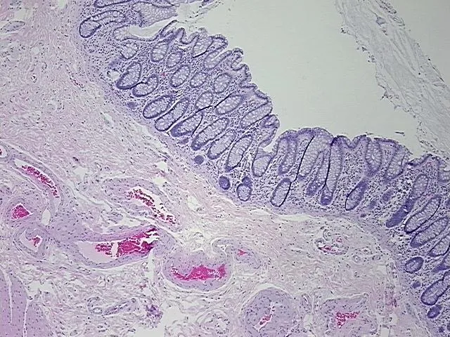 Tissue FFPE Sections, Rectum - image 1