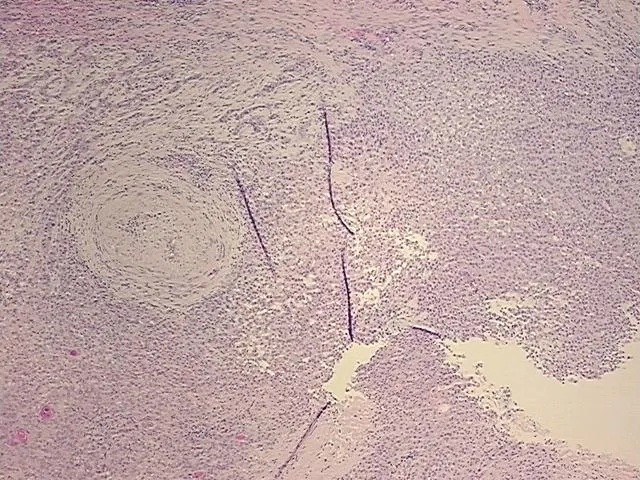 Tissue FFPE Sections, Unknown tissue - image 1