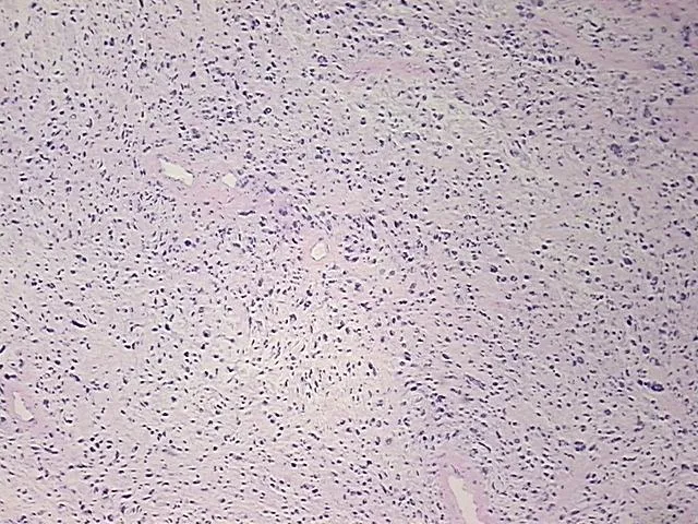 Tissue FFPE Sections, Soft tissue - image 1