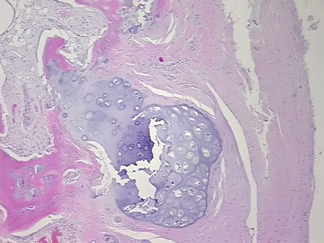 Tissue FFPE Sections, Cartilage - image 1