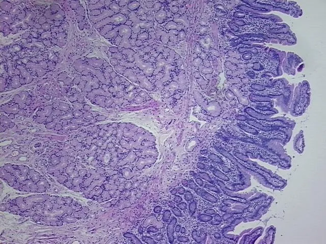 Tissue FFPE Sections, Lung: left lower lobe - image 1