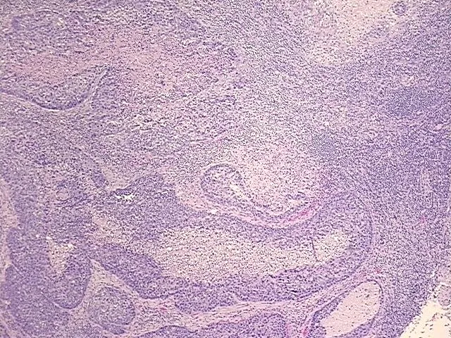 Tissue FFPE Sections, Unknown tissue - image 1