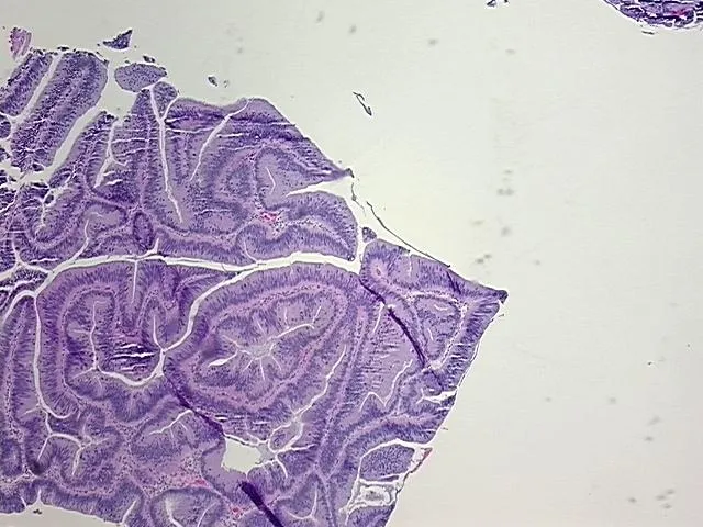 Tissue FFPE Sections, Rectum - image 1