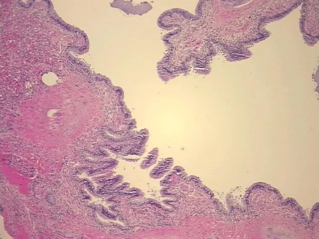Tissue FFPE Sections, Lung - image 1