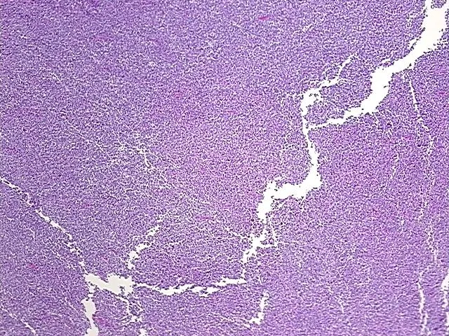 Tissue FFPE Sections, Multiple female reproductive system sites - image 1