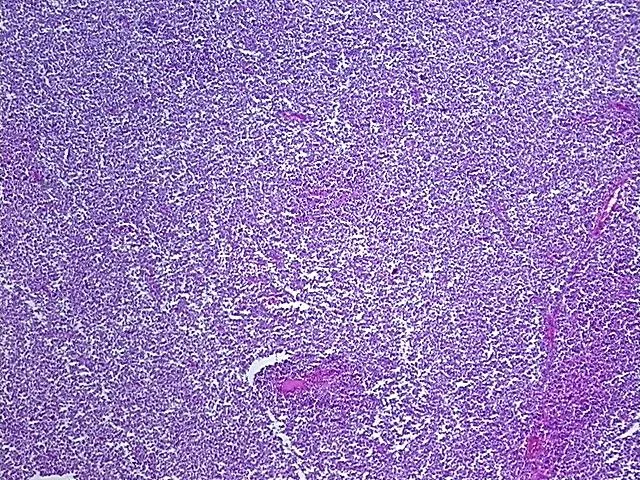 Tissue FFPE Sections, Multiple female reproductive system sites - image 1