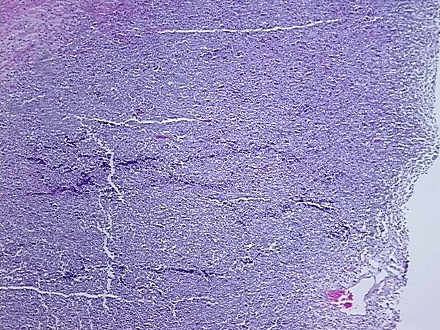Tissue FFPE Sections, Multiple female reproductive system sites - image 1