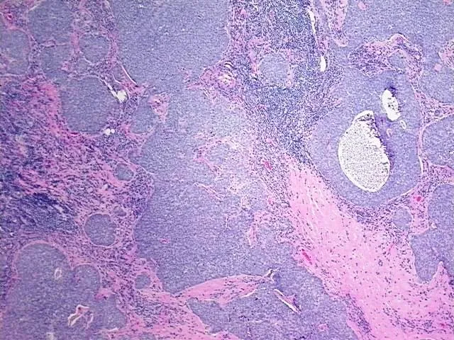 Tissue FFPE Sections, Thymus - image 1