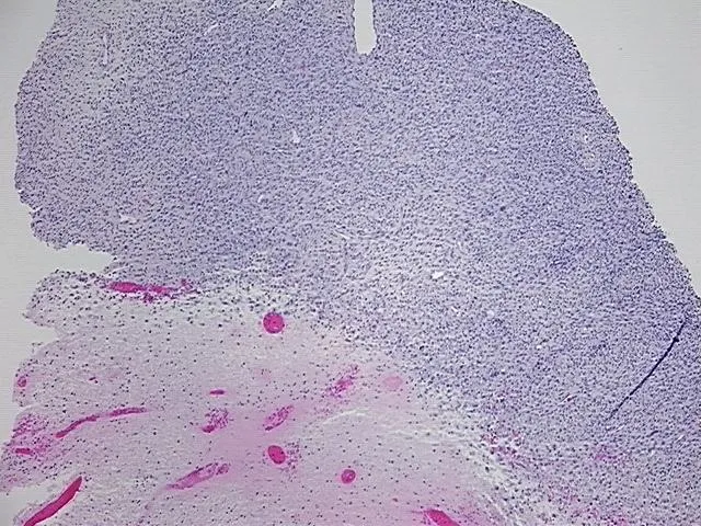 Tissue FFPE Sections, Peripheral nerve - image 1