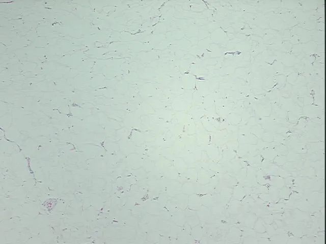 Tissue FFPE Sections, Adipose tissue - image 1