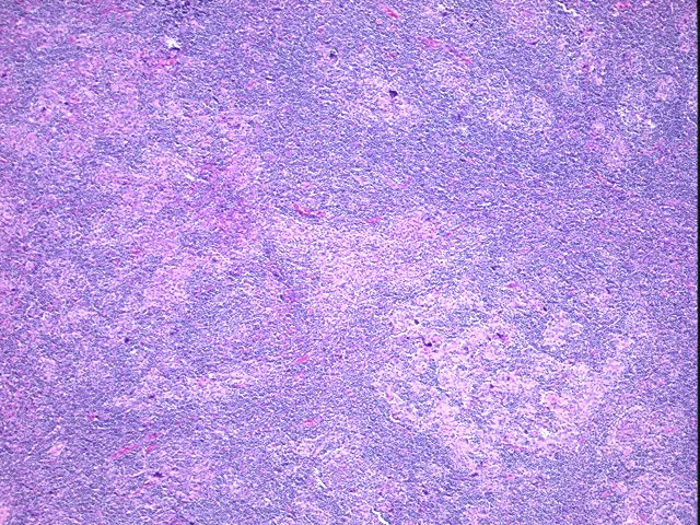 Tissue FFPE Sections, Lymph node - image 1