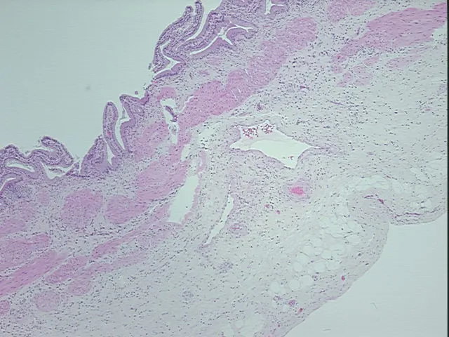 Tissue FFPE Sections, Gallbladder - image 1